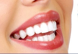 Cómo blanquear los dientes de forma natural, sin dañar el esmalte