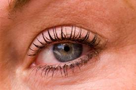 ﻿Cómo aliviar el enrojecimiento de los ojos ﻿
