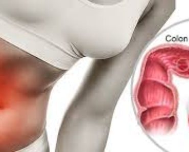 Infusiones para el colon irritable